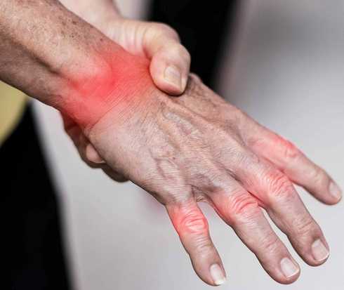 Rot gekennzeichnete Gelenke an einer Hand