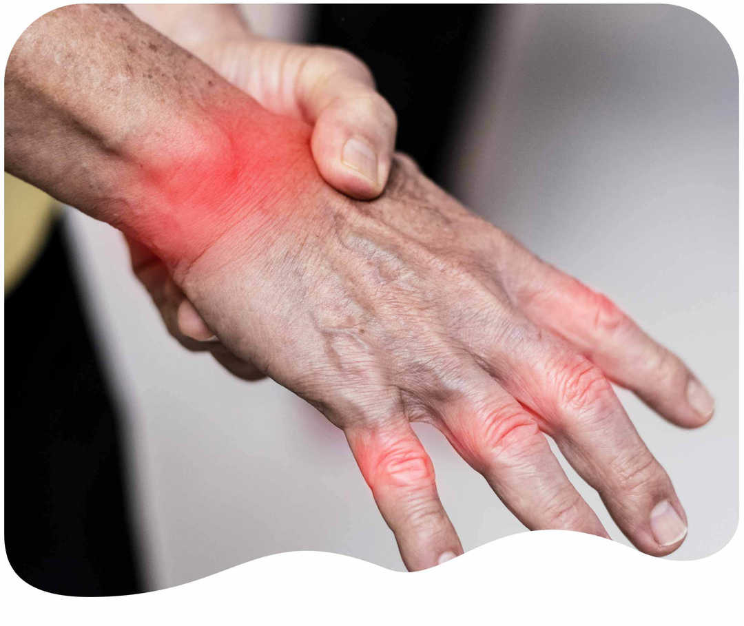Eine Hand auf der die Gelenke rot markiert sind