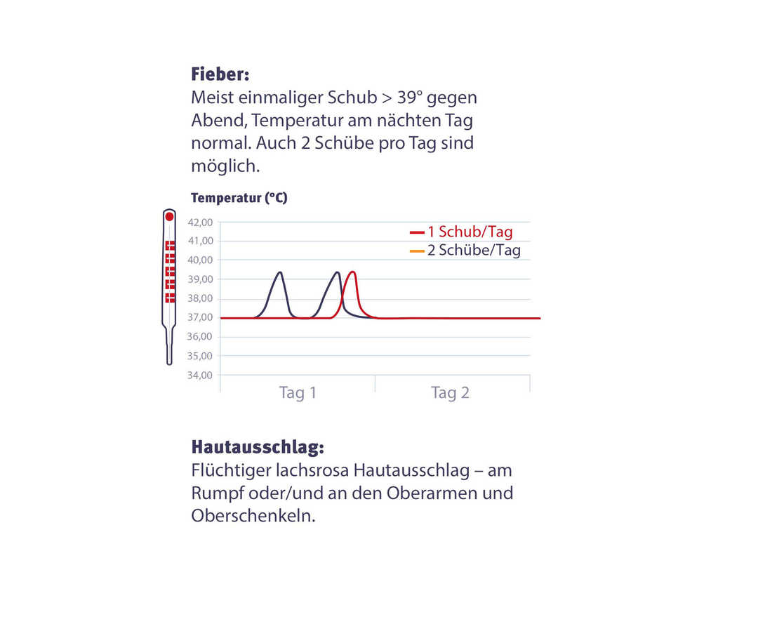 Mögliche Fieber Symptome AOSD