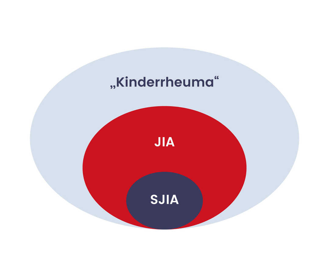 Grafik Unterscheidung Kinderrheuma in JIA und SJIA