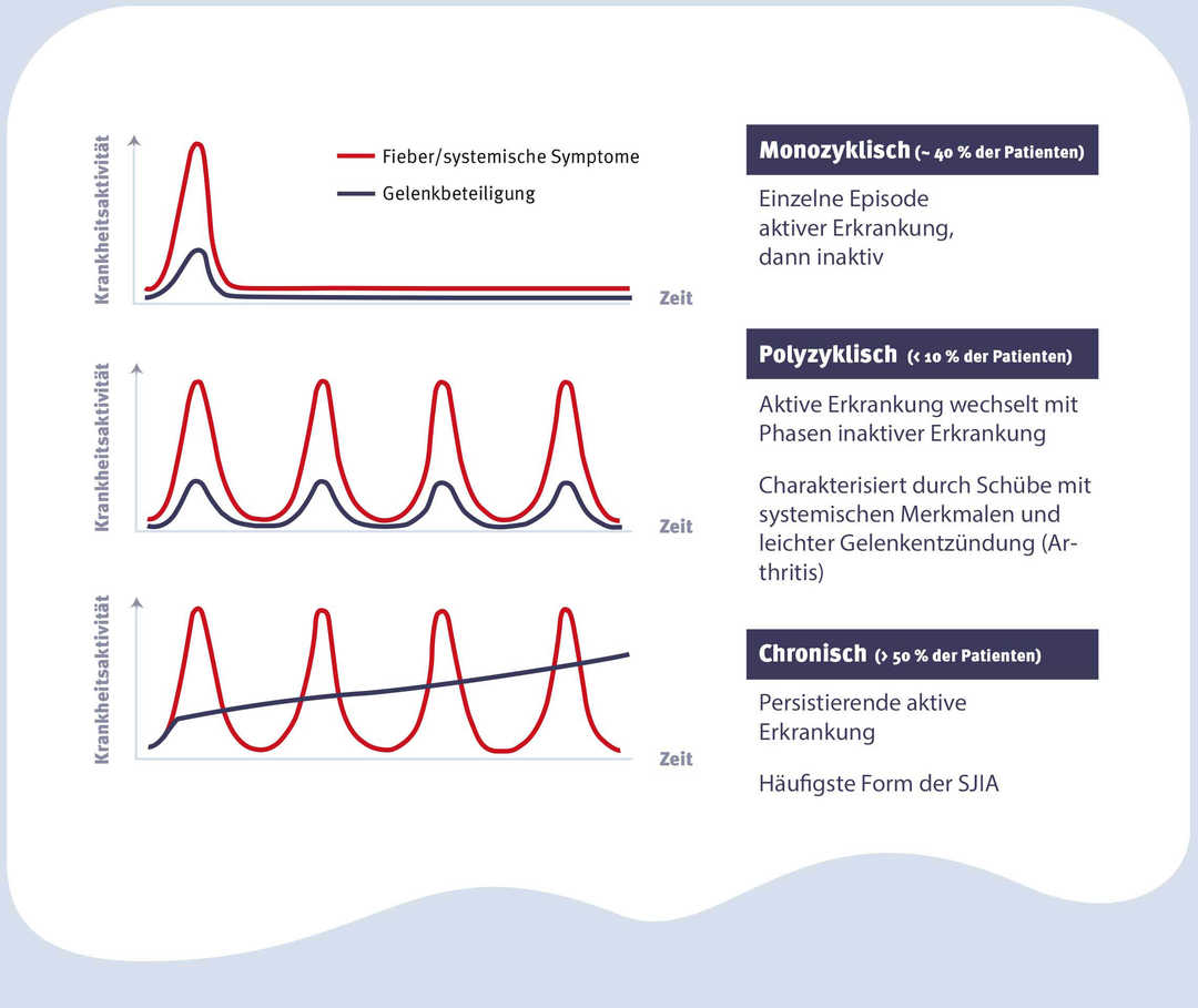 Krankheitsverlauf bei juvenilem Morbus Still (SJIA)
