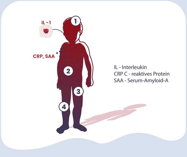 Wirkung IL-1 Autoinflammatorische Erkrankungen Grafik
